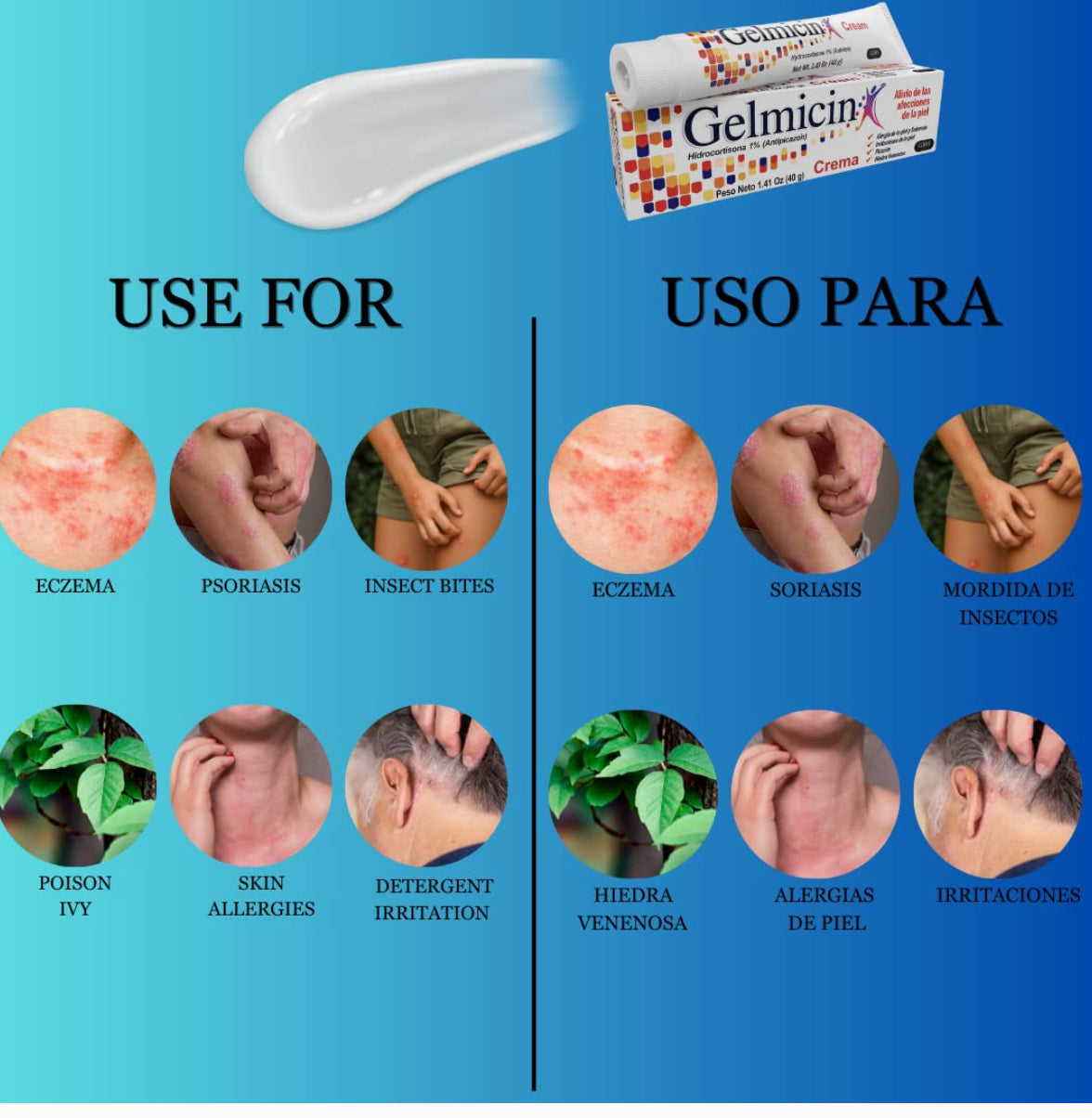 Gelmicin Hidrocortisona 1% - Crema antipicazón, erupción